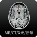 影像解剖图谱app v4.5.8安卓版