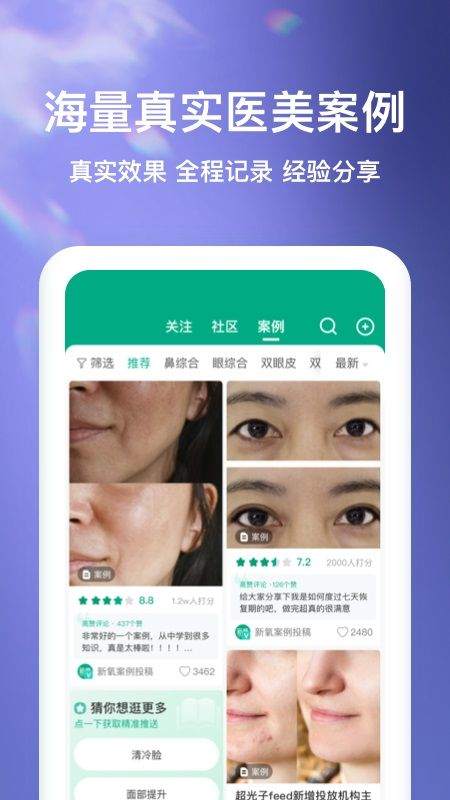 新氧极速版app v9.92.0安卓版